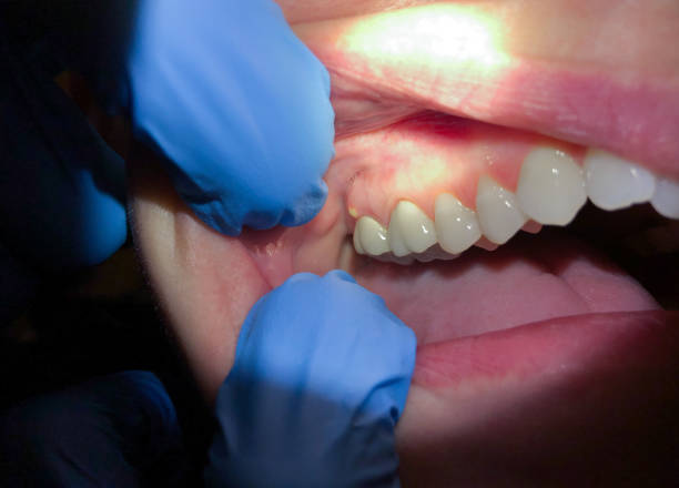 Best Orthodontic Emergency Dentist in Mount Ayr, IA