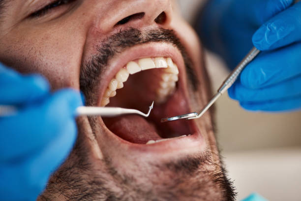 Best Emergency Dental Extractions in Mount Ayr, IA
